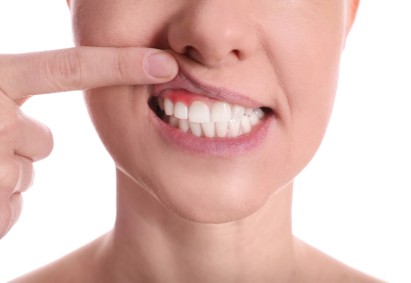 Periodontal Treatment in Portage, MI